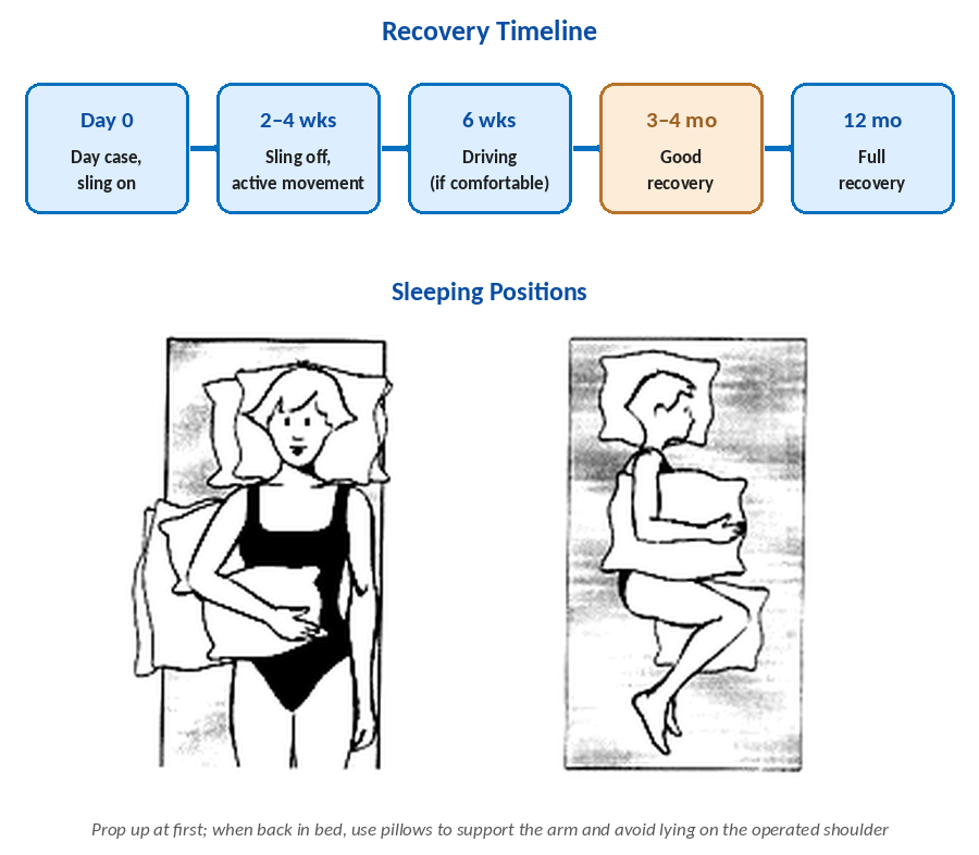 Recovery timeline graphic and recommended sleeping positions after shoulder surgery