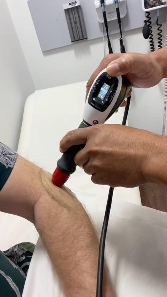 Shockwave therapy being applied to the elbow