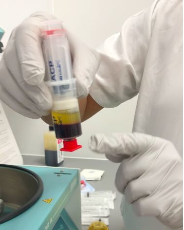 Preparation of a PRP (Platelet Rich Plasma) injection